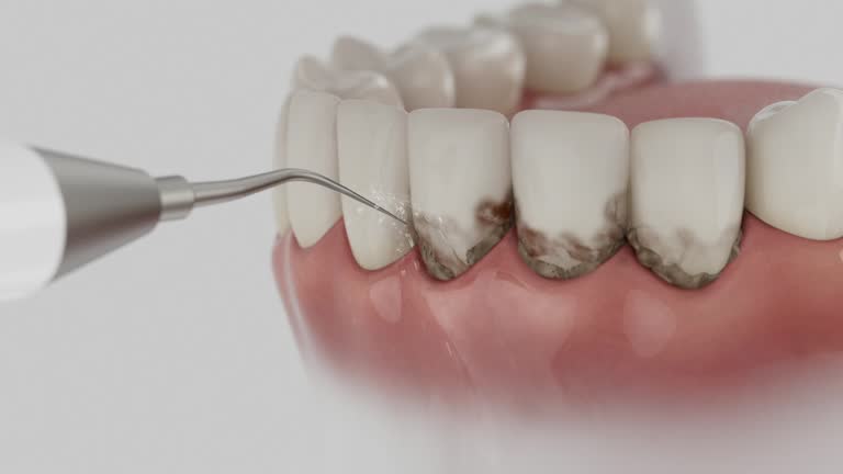 Reliable Tooth Extraction contractor in Elkhart, KS by Smile Center Dentistry